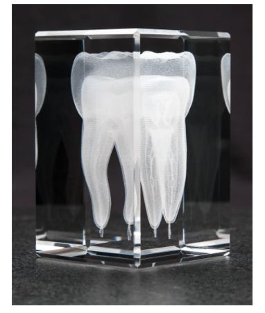 Crystal Tooth Model